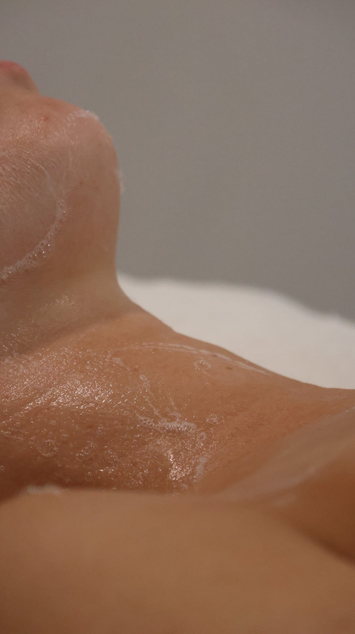 Perioral Dermatitis